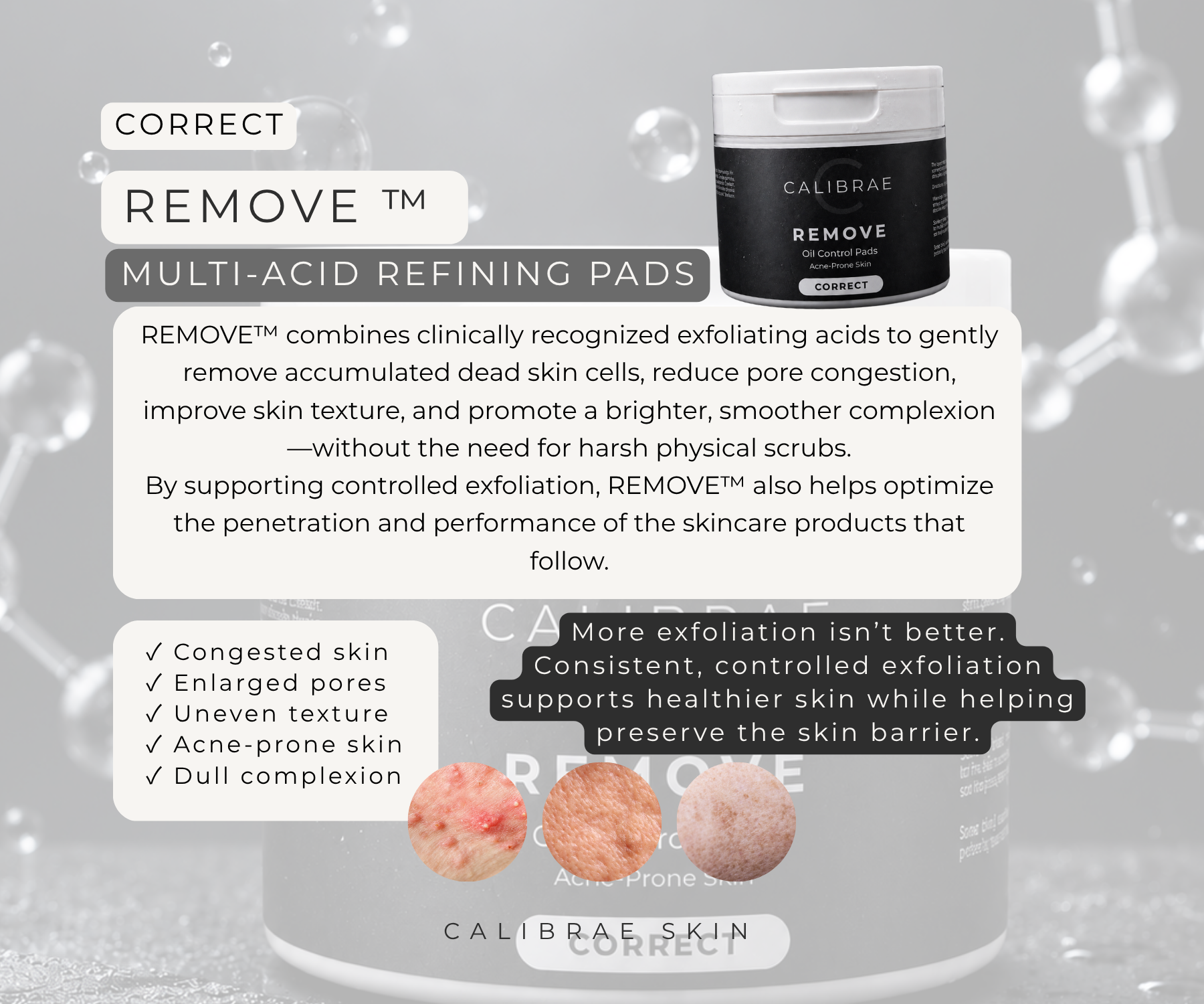 CALIBRAE™ CORRECT REMOVE – Multi-Acid Refining Pads