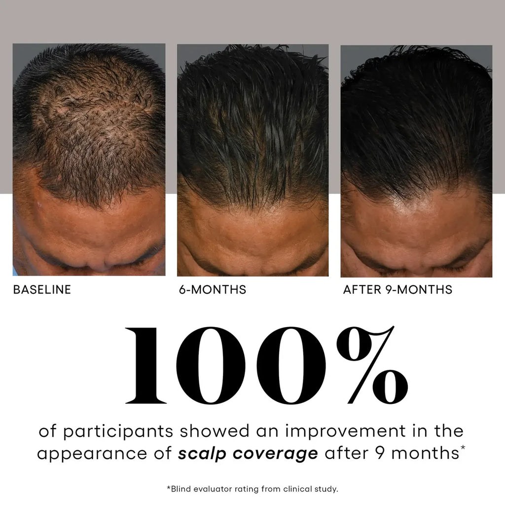 CALIBRAE™ BUILD REGENERATIVE HAIR – ( plated )™ Hair Serum (30 mL)